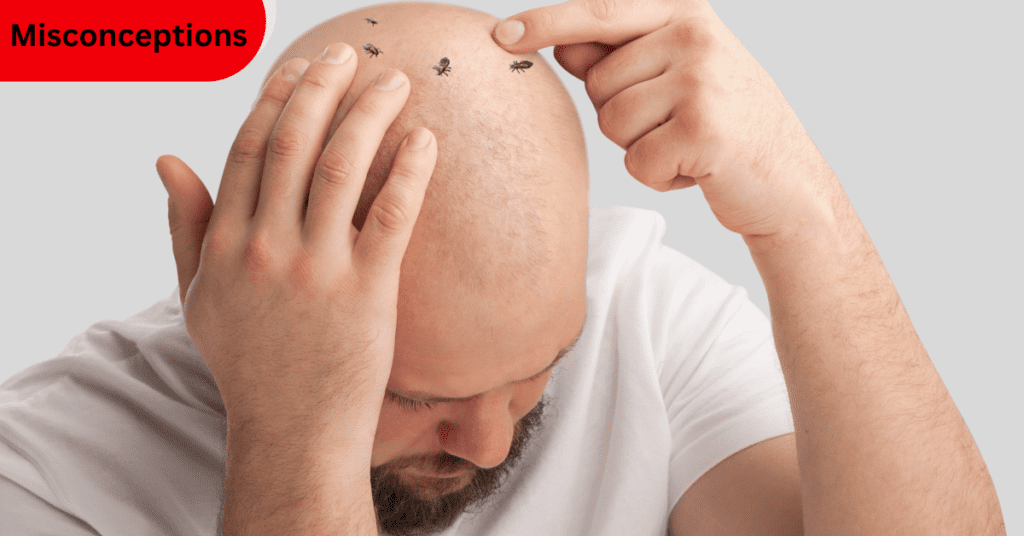 Can bald people get lice?