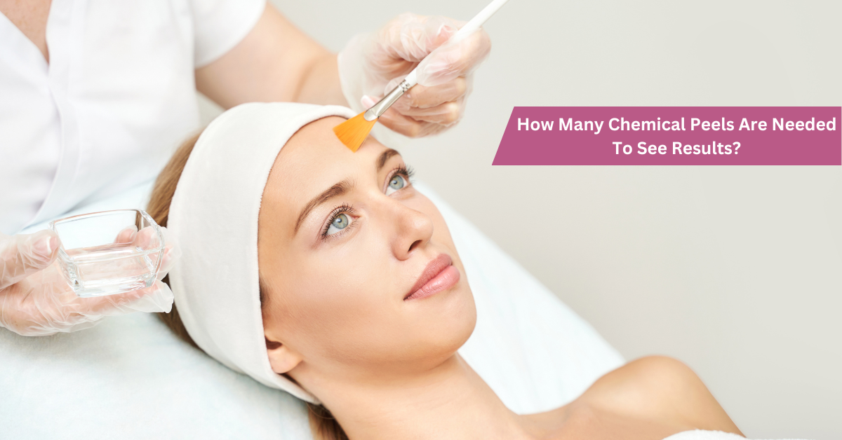 How Many Chemical Peels Are Needed To See Results?