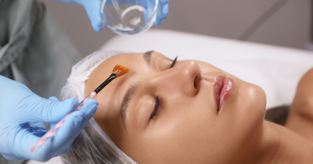 How Many Chemical Peels Are Needed To See Results?