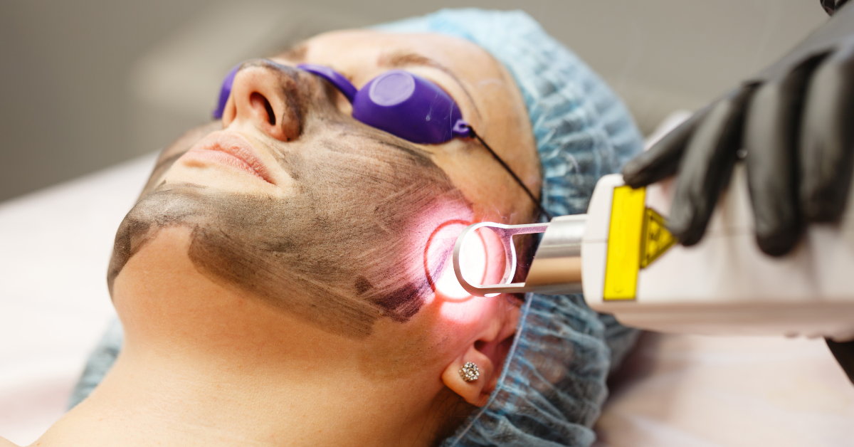 How Long Do ClearLift Laser Results Last?